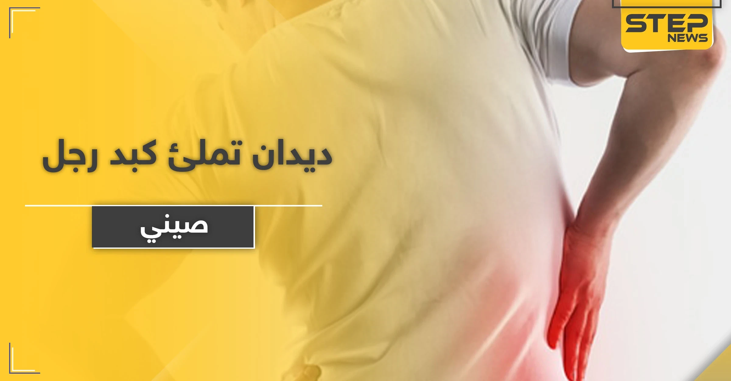 بالصور|| ديدان تملئ كبد رجل صيني.. والأطباء يضطرون لإستئصال جزء كبير منه ويوضحون الأسباب