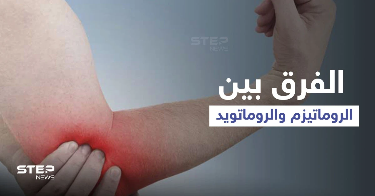 الفرق بين الروماتيزم والروماتويد.. إليك أهم المعلومات
