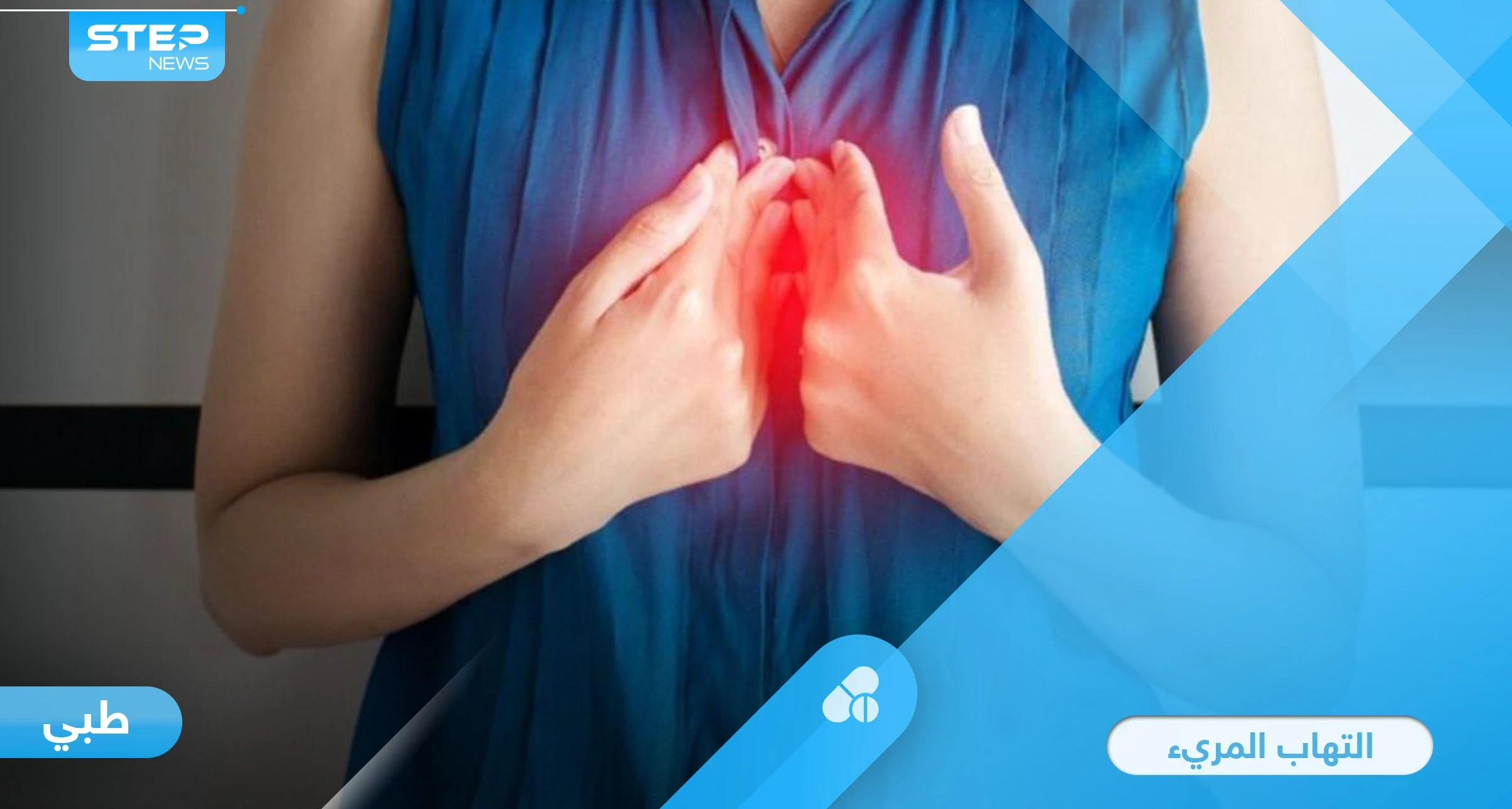 ما هو التهاب المريء ومضاعفاته الخطيرة وطرق العلاج إليك أهم المعلومات