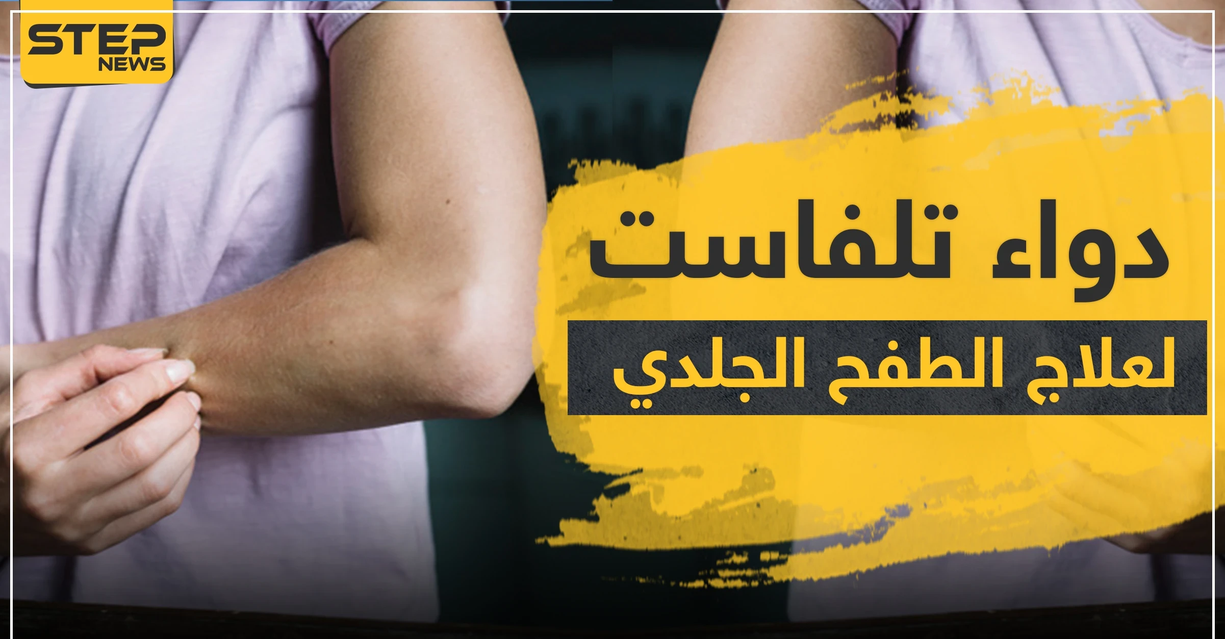 دواء تلفاست لعلاج الطفح الجلدي