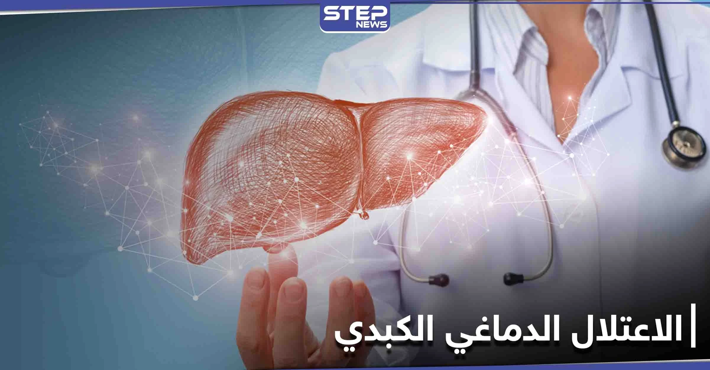 تعرف على مرض الاعتلال الدماغي الكبدي وآثاره على الاضطراب العقلي وأسبابه الرئيسية