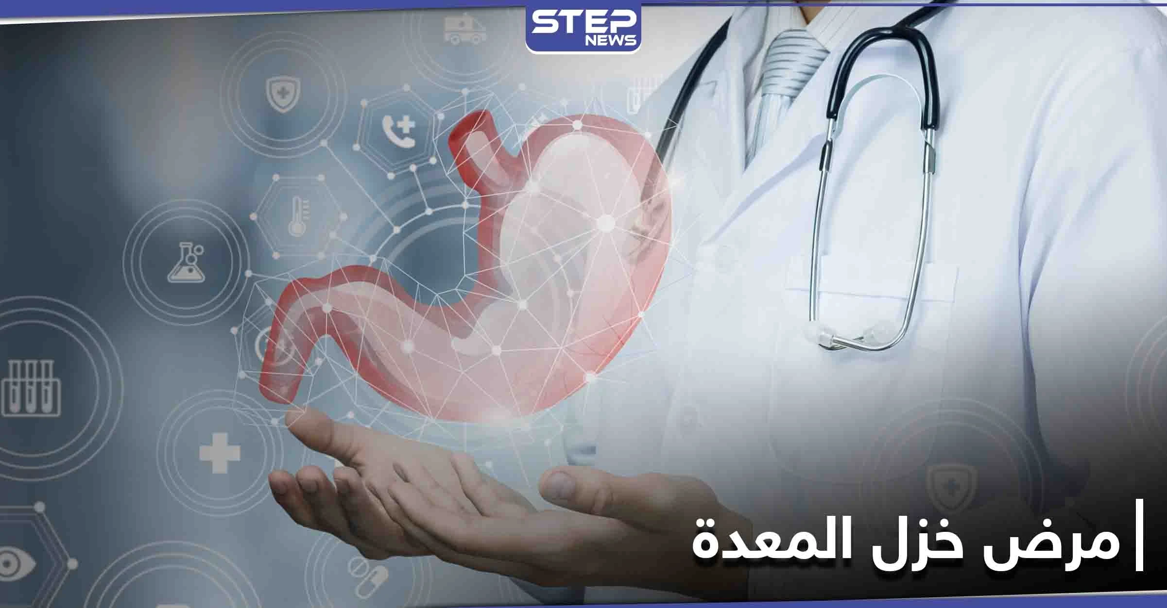 ما هو مرض خزل المعدة وكيف يعطل عمل الجهاز الهضمي وأسبابه وطرق العلاج