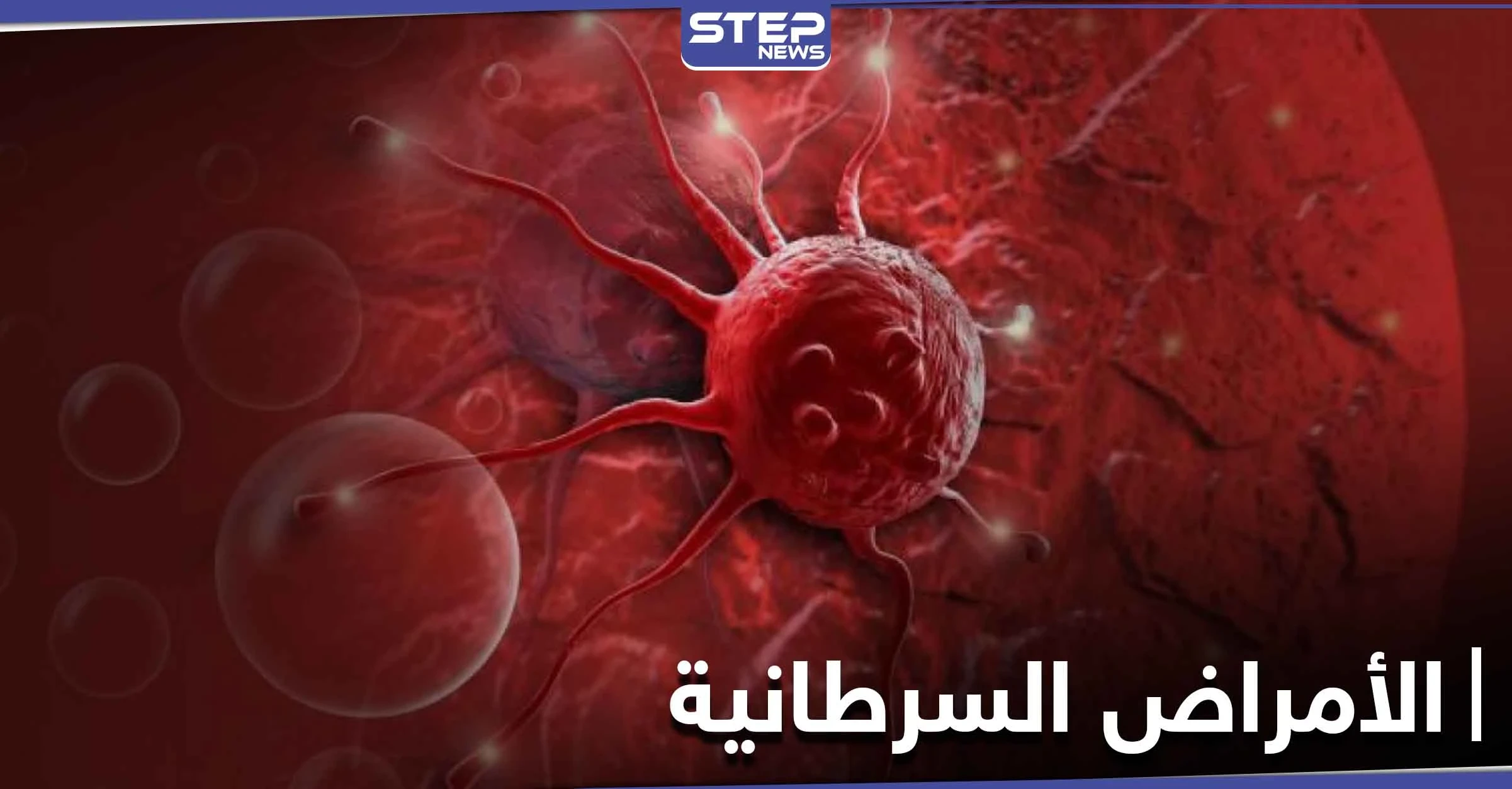 نصائح هامة عليك معرفتها.. لتجنب الإصابة بالأمراض السرطانية القاتلة