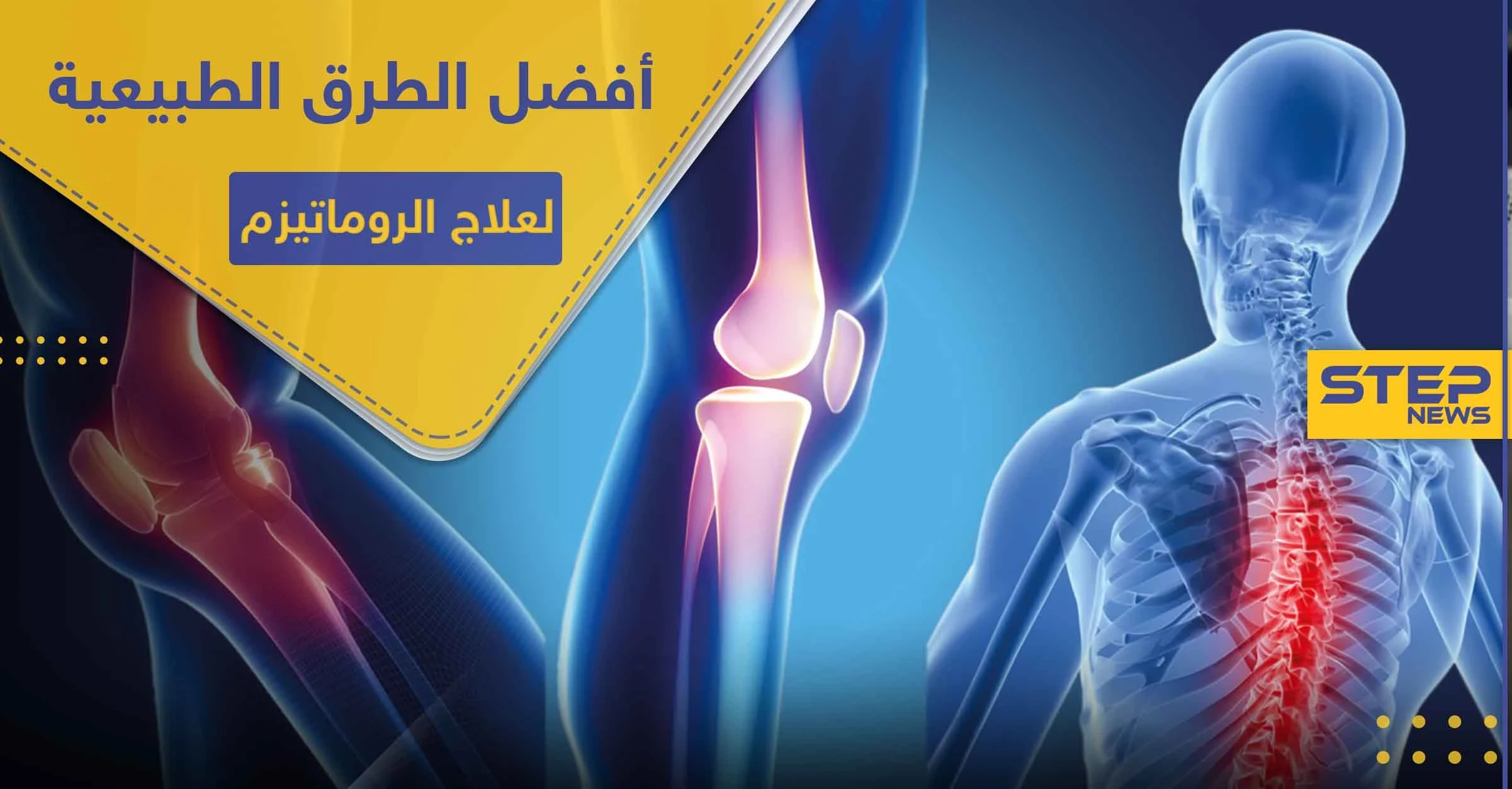 أفضل الطرق الطبيعية لعلاج الروماتيزم ..والتخلص من الآلام المزمنة