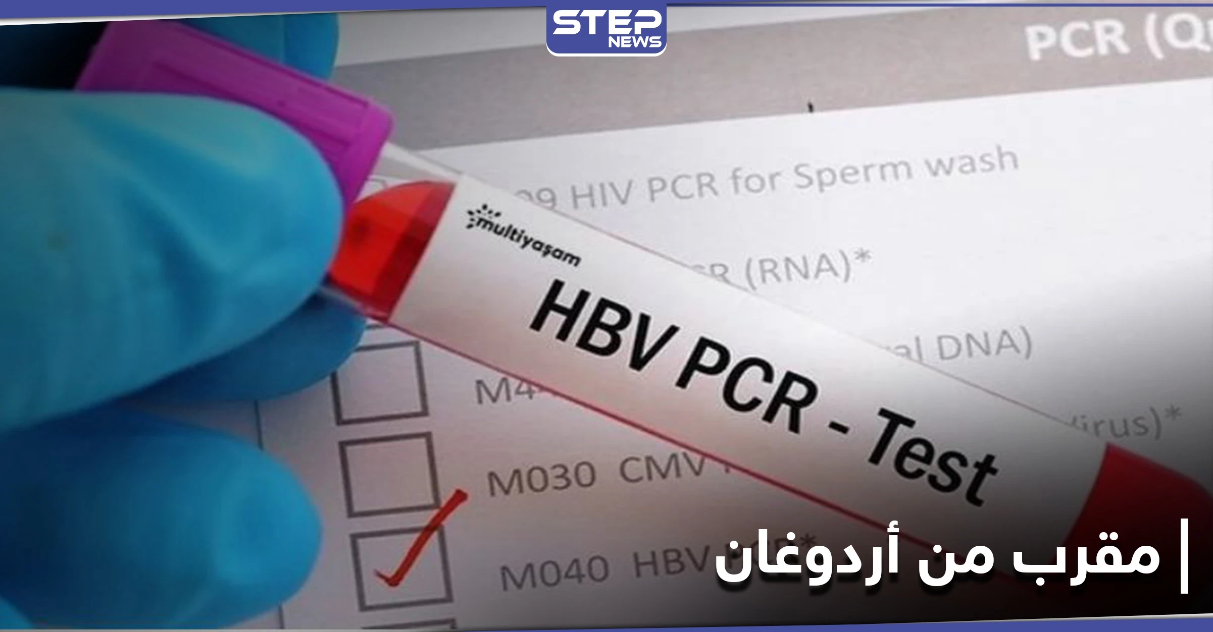 مسؤول تركي مقرب من أردوغان يعلن إصابته وزوجته بفيروس كورونا