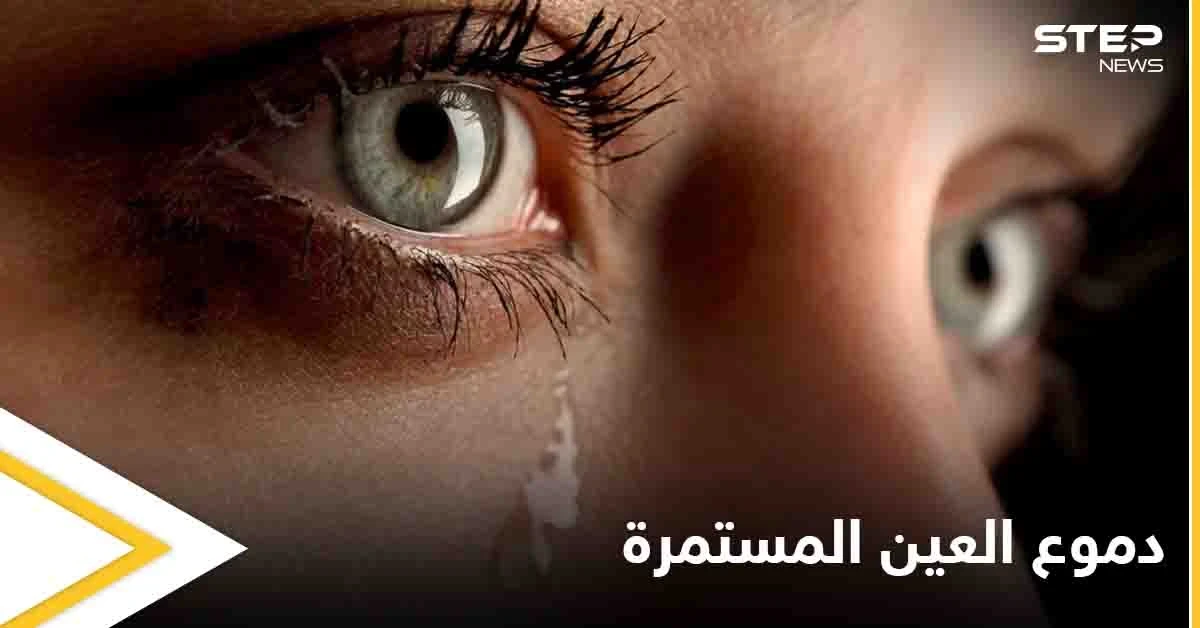 تعرف على أسباب دموع العين المستمرة وطرق علاجها