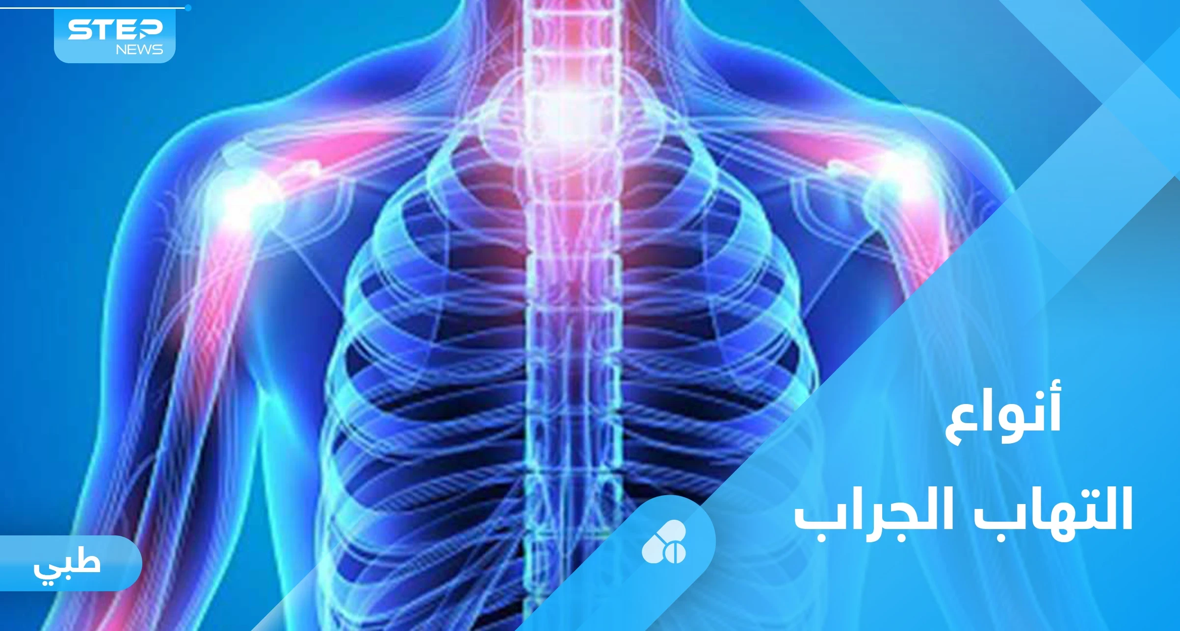 التهاب الجراب وآلام المفاصل.. كل ما عليك معرفته
