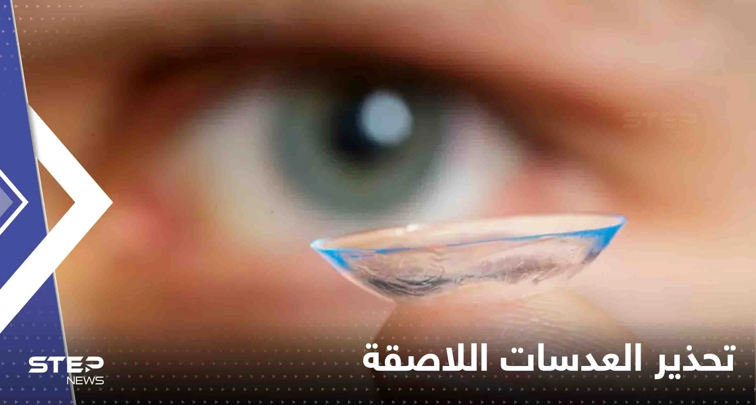 شاب يفقد بصره جزئياً بسبب العدسات اللاصقة.. وخبراء يحذرون