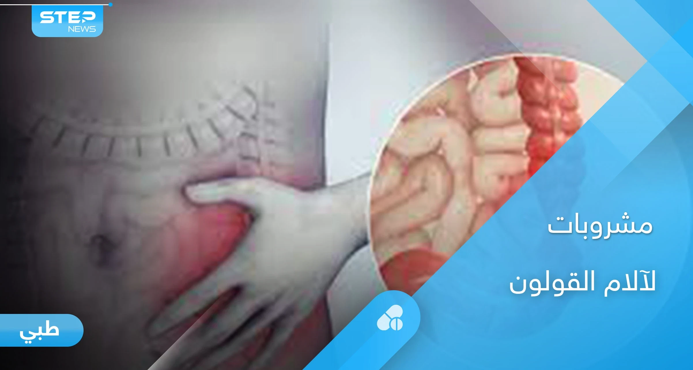دور السوائل والمشروبات في علاج آلام القولون والأكثر فائدة بينها