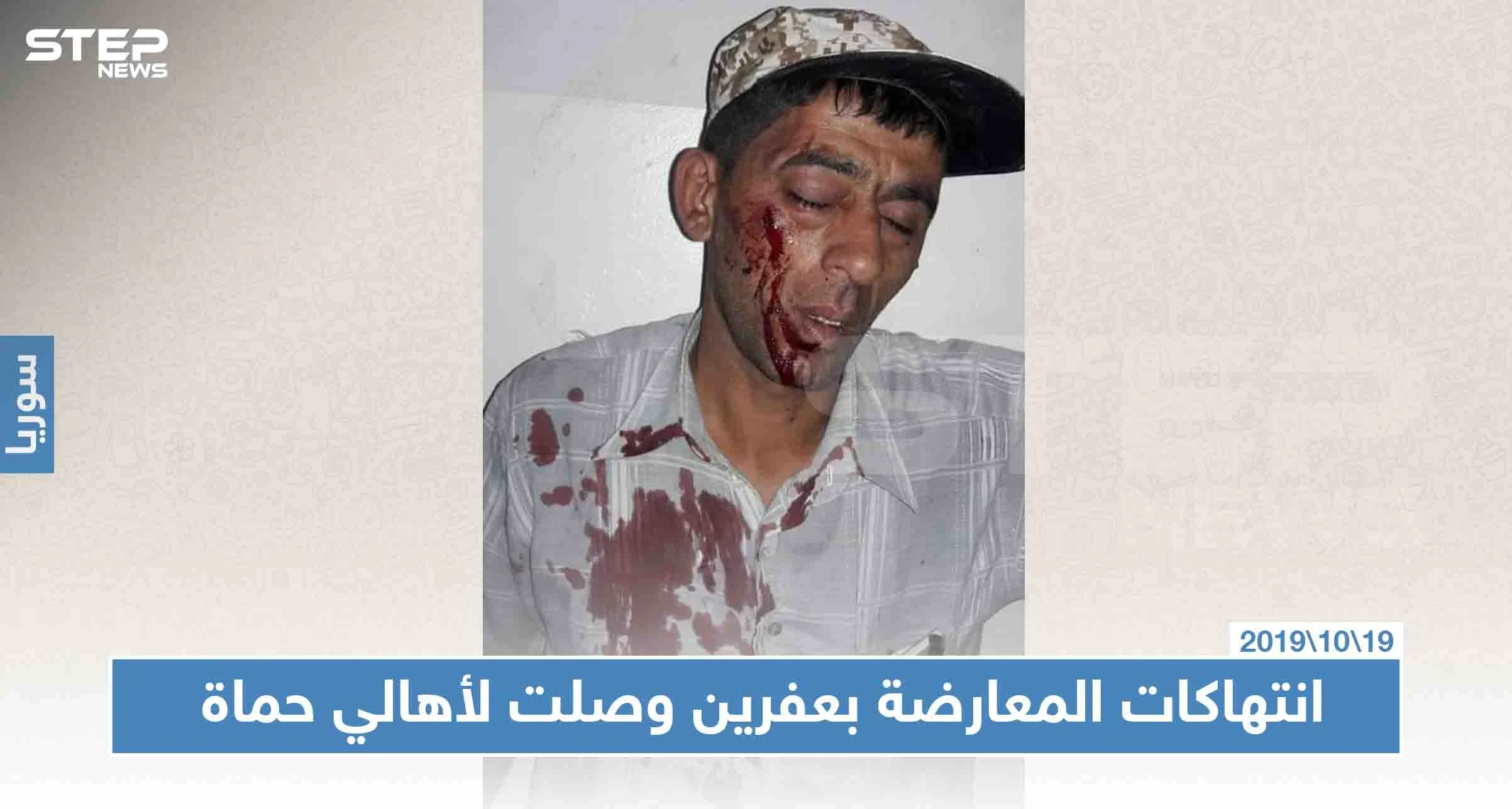 عناصر فيلق الشام يعتدون على نازح من حماة بالضرب المبرح، لهذا السبب