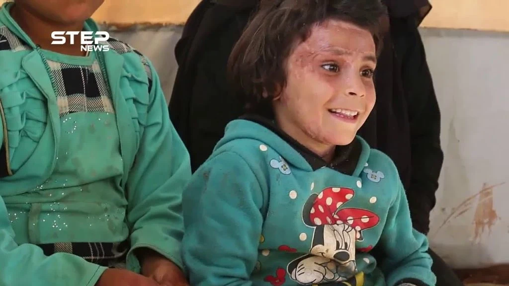 حياة قيد الموت ولعنة الحرب تلاحقها والأمل والصبر سلاحها ... روضة العلي هذه قصتي