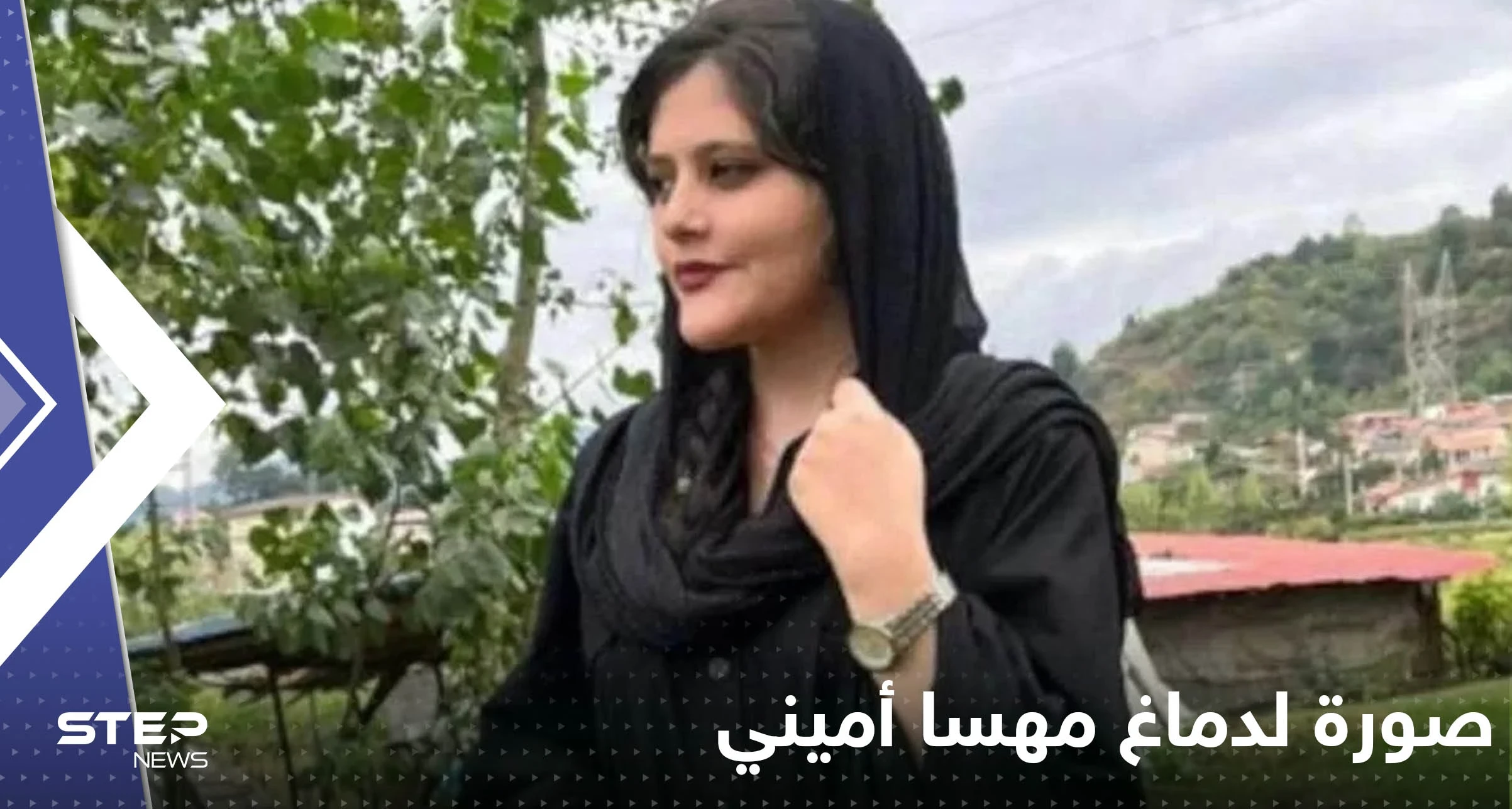 شاهد|| صورة لدماغ مهسا أميني تكشف تفاصيل ما حدث.. وعرض وجوه الجناة لأول مرة