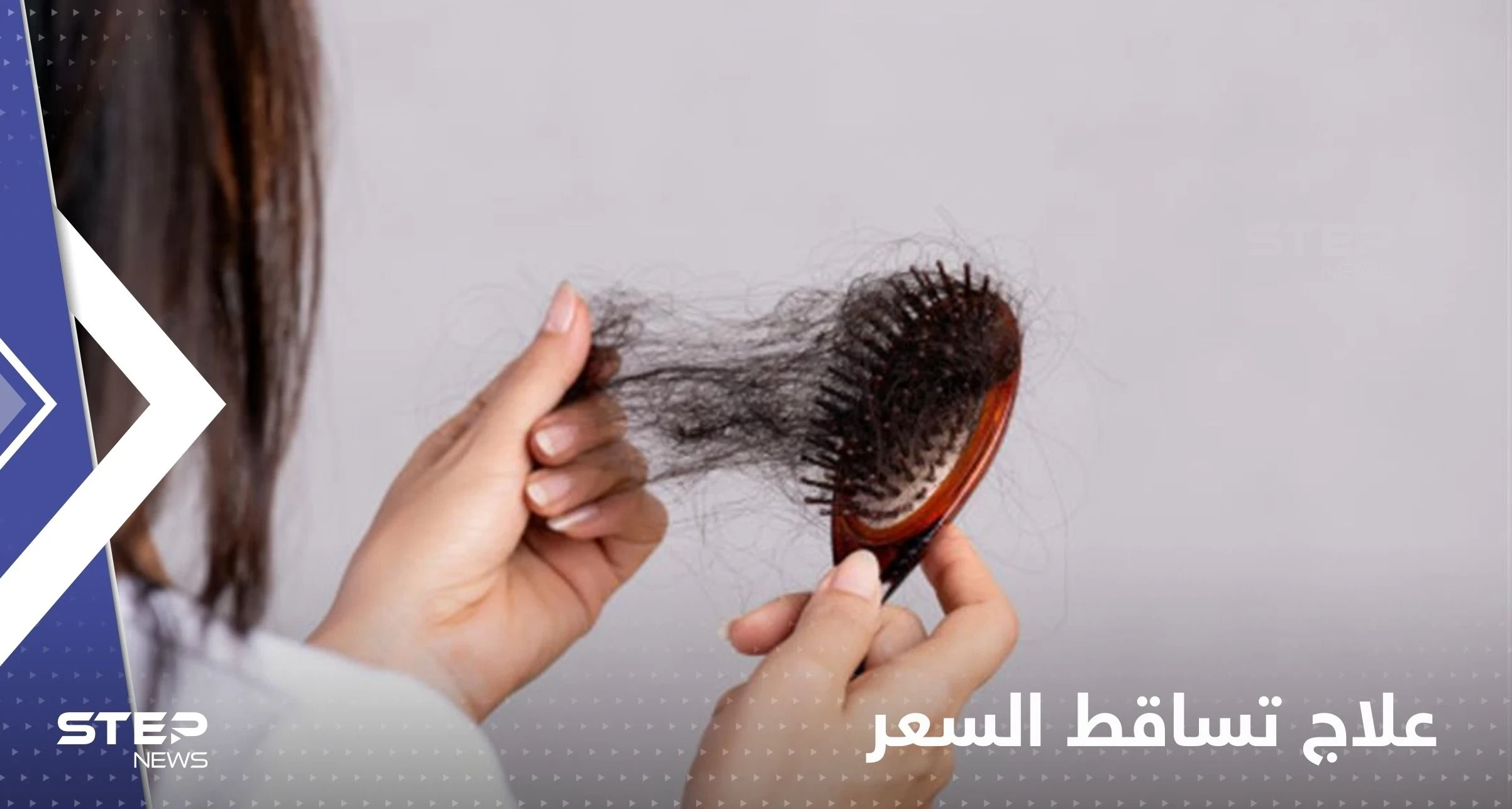 تعاني من تساقط الشعر بكثافة.. إليك 4 أطعمة لحل هذه المشكلة نهائياً