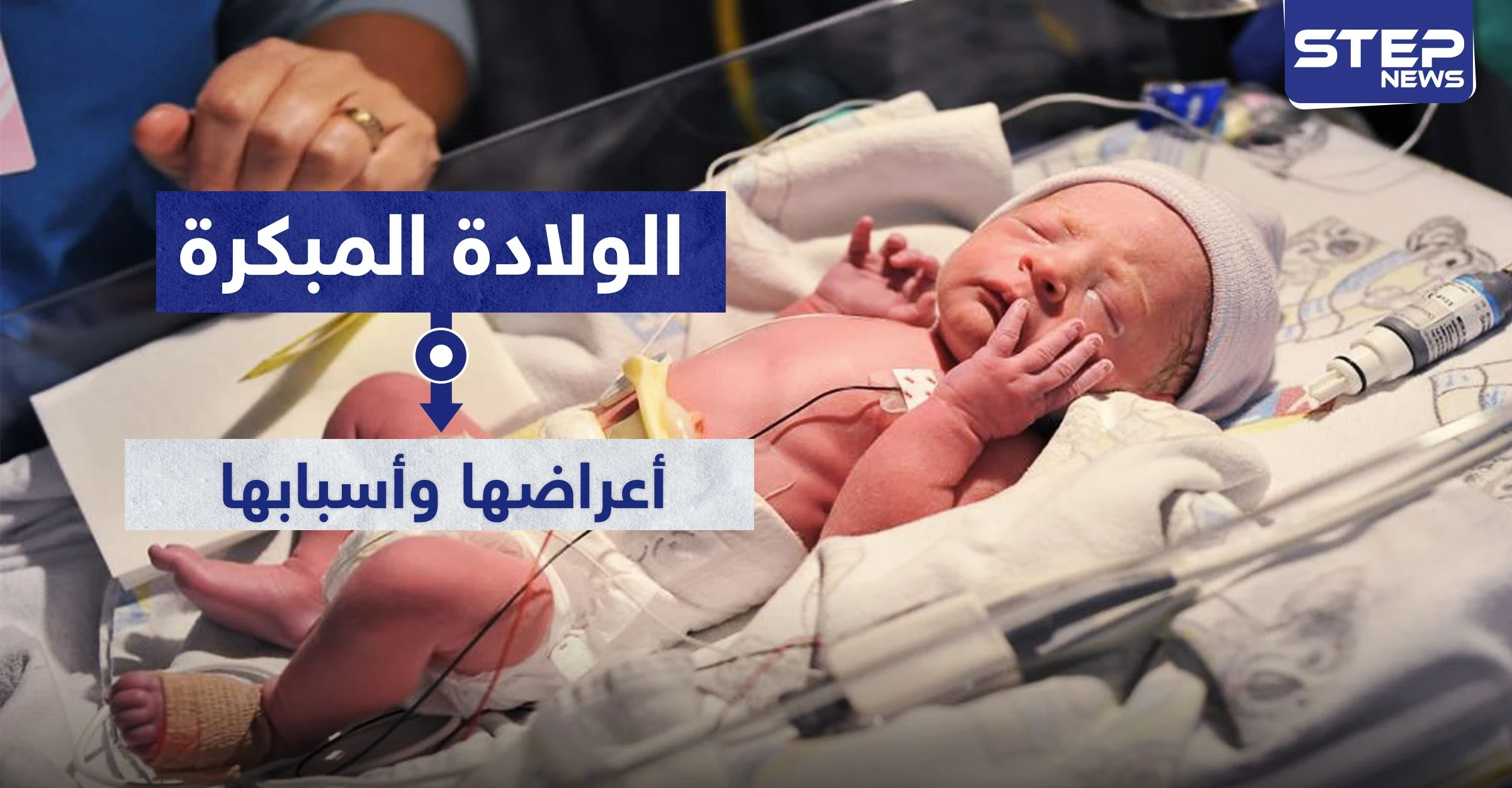 الولادة المبكرة.. أعراضها وأسبابها