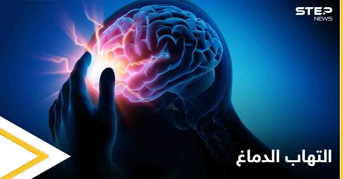 تعرف على مرض التهاب الدماغ ومخاطره الصحية وكيفية الوقاية منه