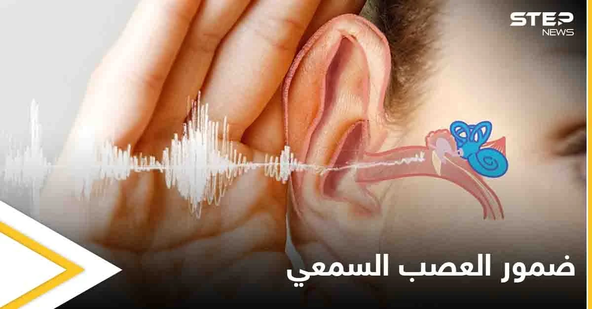 تعرف على مرض ضمور العصب السمعي أسبابه وأعراضه وطرق العلاج