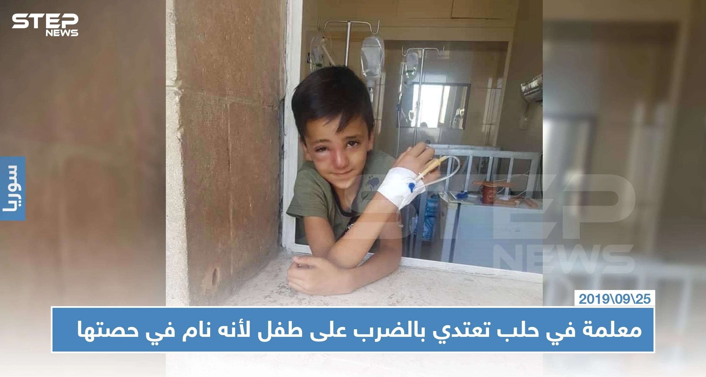 معلمة بحلب تعتدي بالضرب على طفل وتكسر أنفه لنومه في الحصة الدراسية