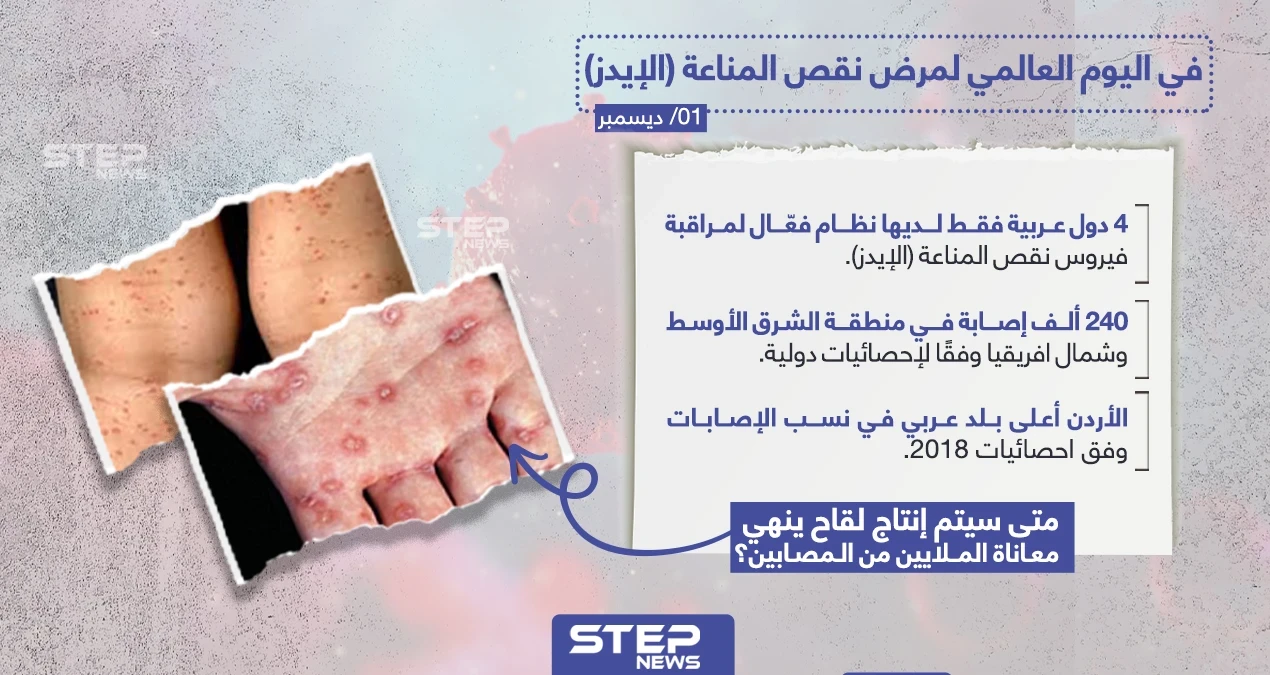 متى سيتم انتاج لقاح ينهي معاناة مرضى الإيدز؟