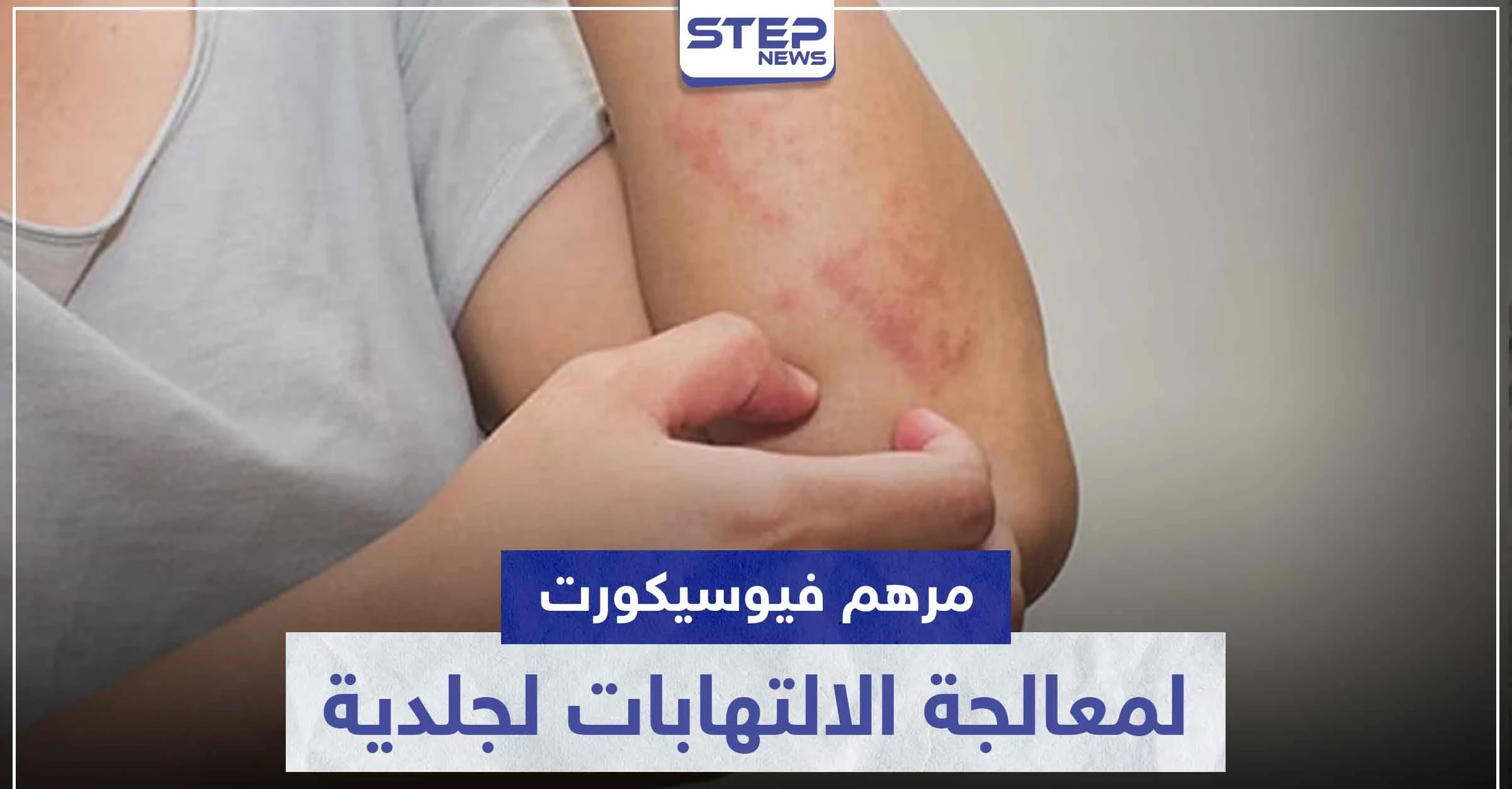 مرهم فيوسيكورت FUCICORT لمعالجة الالتهابات لجلدية