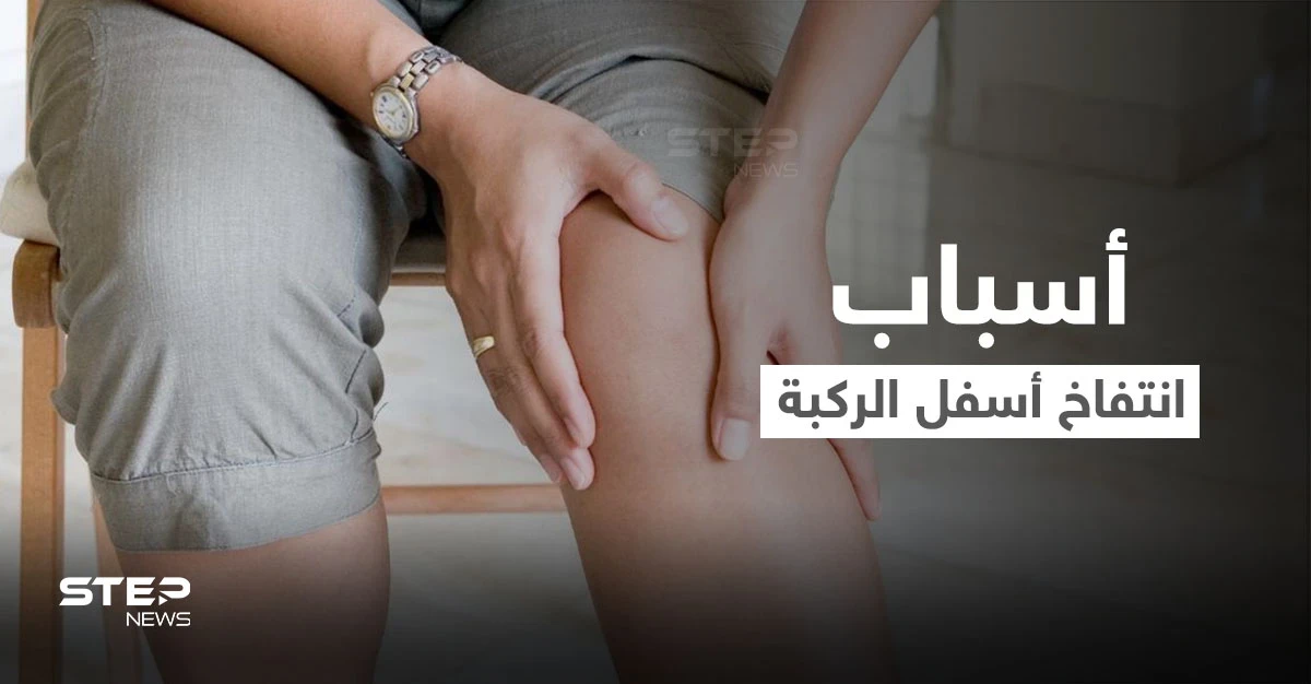 تعرف على أسباب انتفاخ أسفل الركبة وطرق العلاج