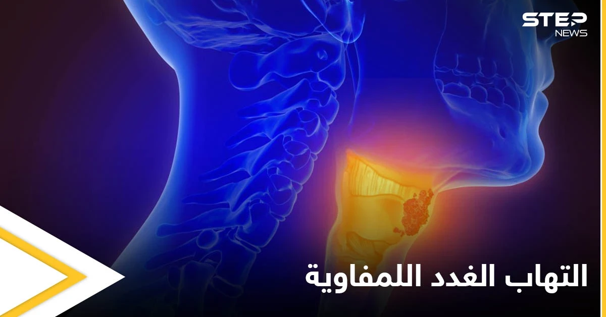 أسباب التهاب الغدد اللمفاوية و أهم طرق علاجها في المنزل
