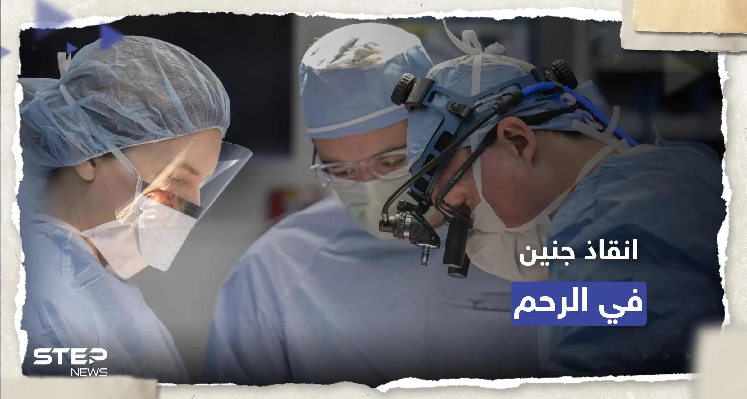 الأولى من نوعها.. جراحة ناجحة لدماغ جنين برحم أمه