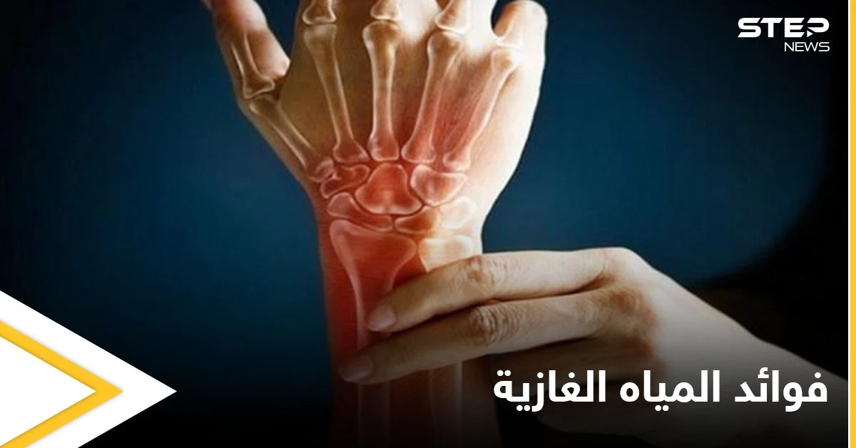 منها تعزيز صحة العظام.. تعرف على فوائد المياه الغازية ومضارها الجانبية