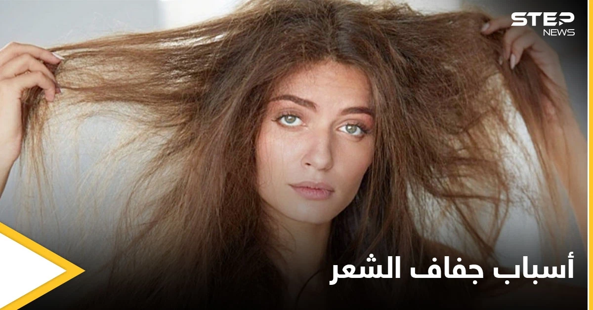 أسباب جفاف الشعر.. متى يحتاج للتدخل الطبي وطرق العلاج الطبيعية في المنزل