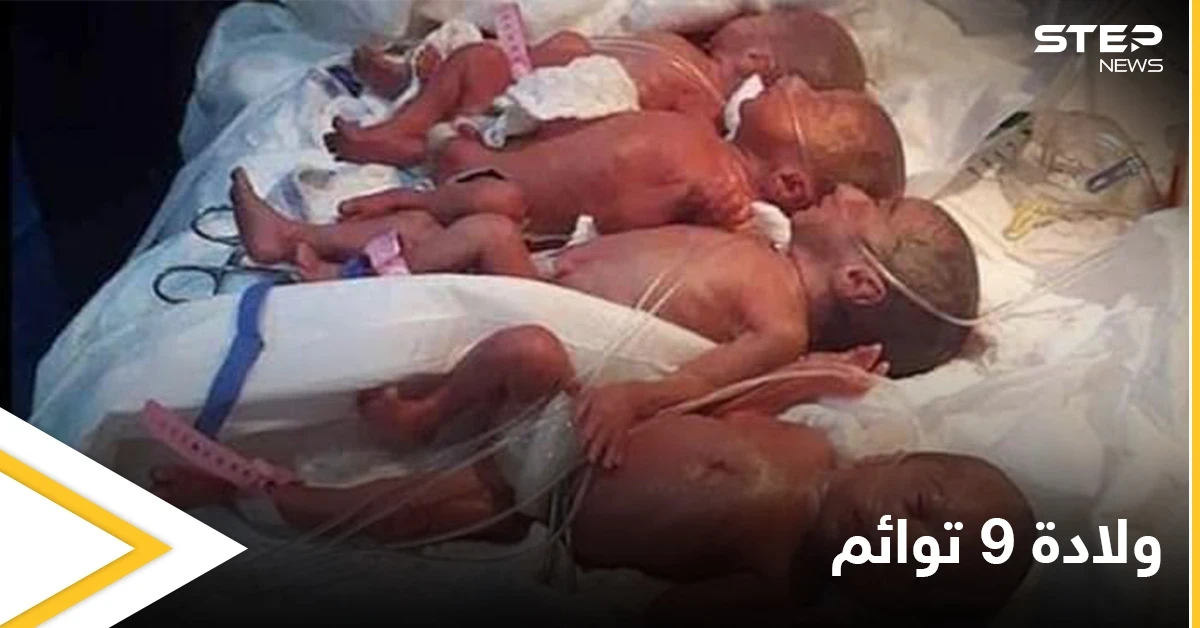 شاهد بالصور|| في حالة نادرة.. ولادة 9 أطفال من أم واحدة تتطلب تدخل السلطات