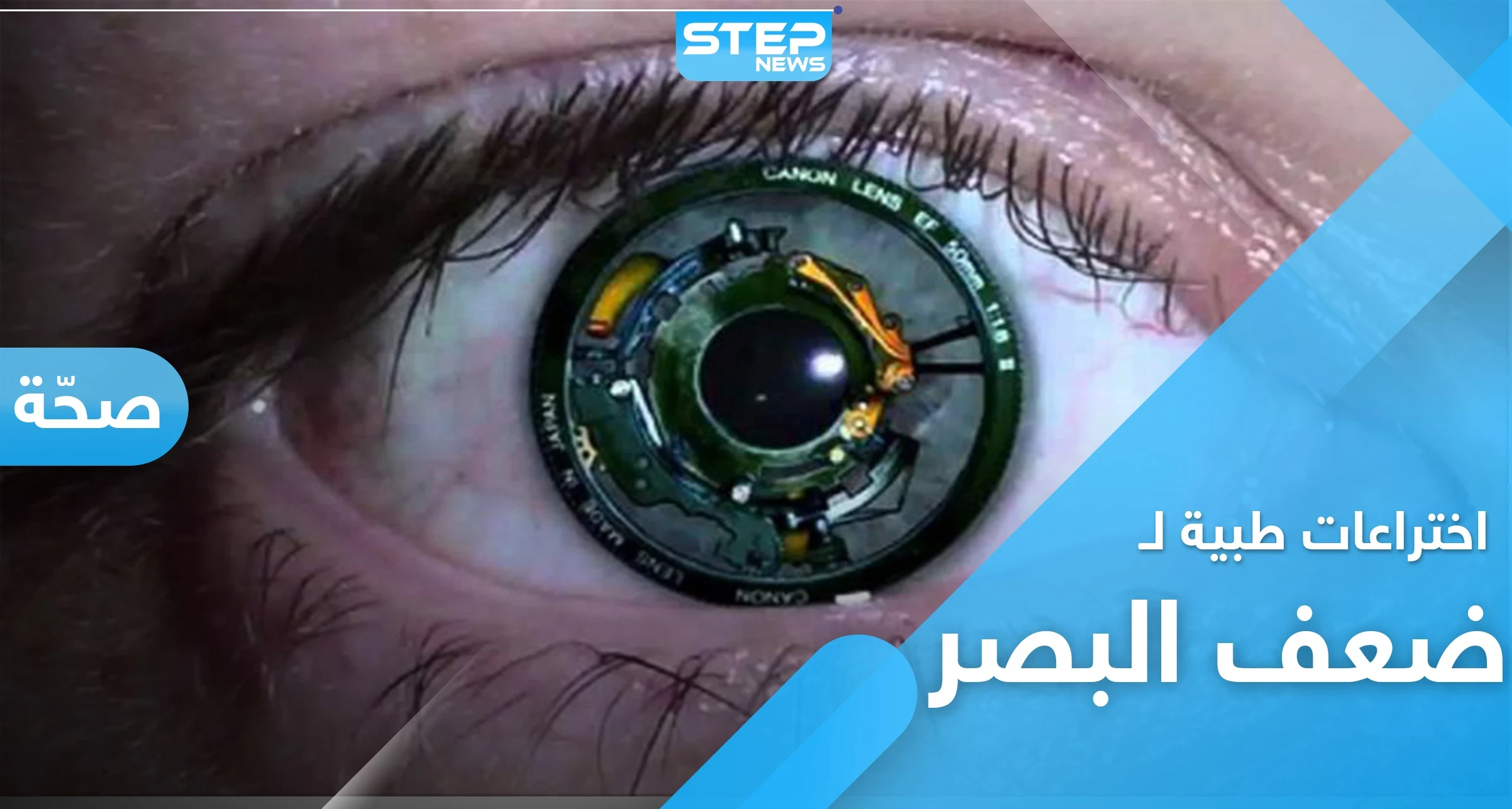 اختراعات تخلصك من ضعف النظر.. تعرّف على العين الصناعية والشبكية الحية