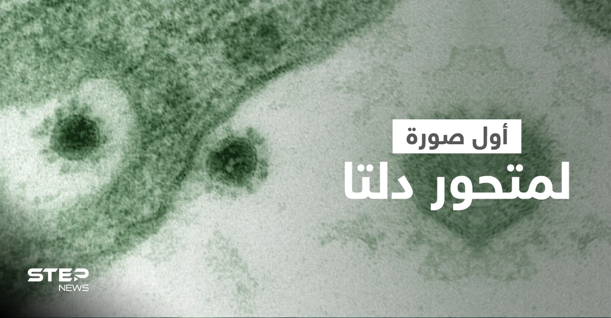 شاهد مجهر إلكتروني يلتقط أول صورة لـ متحور دلتا ينمو كخلايا القرد الأفريقي (صورة)
