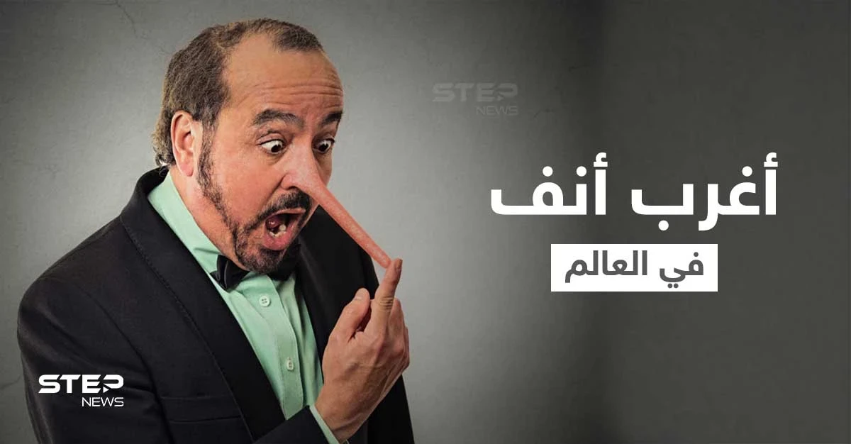 شاهد|| "أرسل الله ملاكاً للاعتناء بي".. صاحب أغرب أنف في العالم يكشف كيف عاد شكل وجهه لطبيعته
