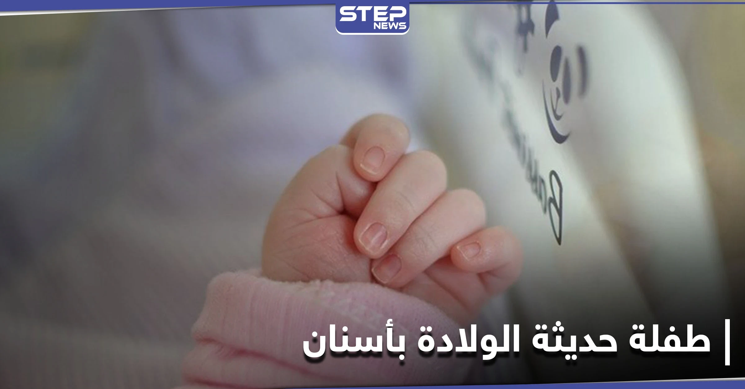 شاهد|| طفلة حديثة الولادة تملك أسناناً.. حالة طبية نادرة في مصر