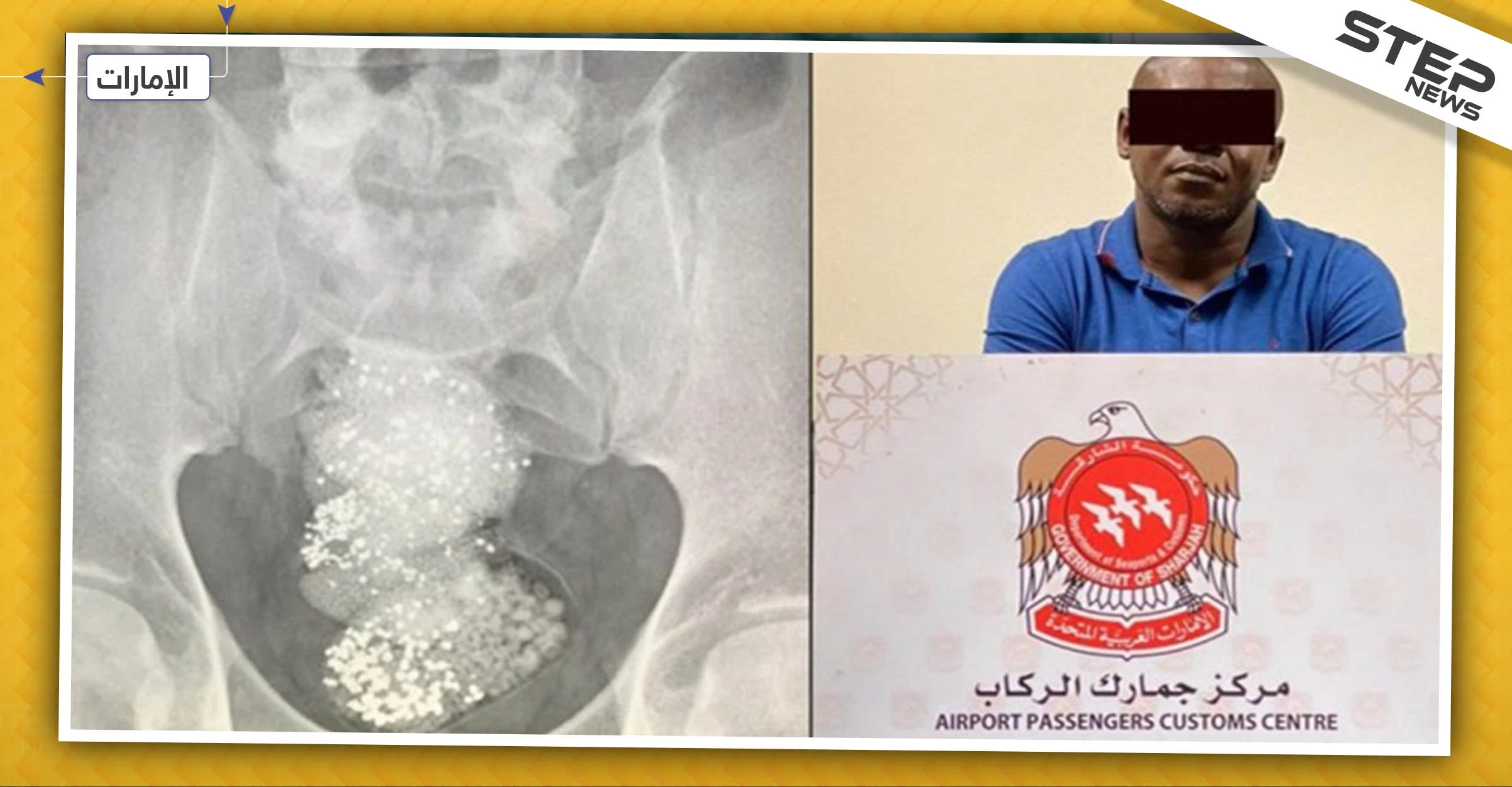 السلطات الإماراتية تلقي القبض على "مهرّب" أخفى الألماس في أحشائه