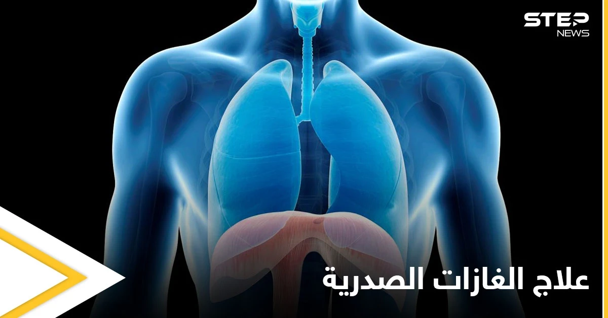 علاج الغازات الصدرية في المنزل وعلاقتها بآلام القلب إليك أهم المعلومات