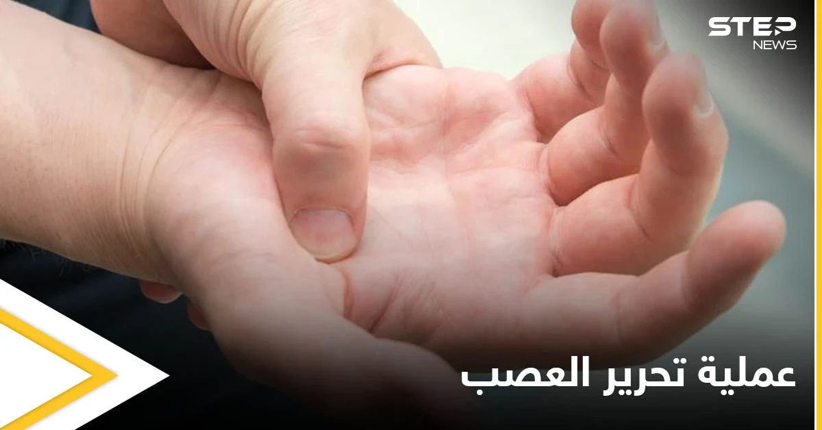 عملية تحرير العصب.. متى يجب إجراؤها وأنواعها إليك أهم المعلومات