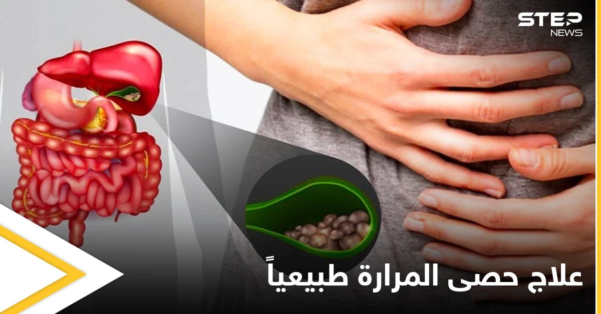 للتخلص من حصى المرارة.. تطهيرها وغسلها بزيت الزيتون إليك الوصفات وأهم المعلومات