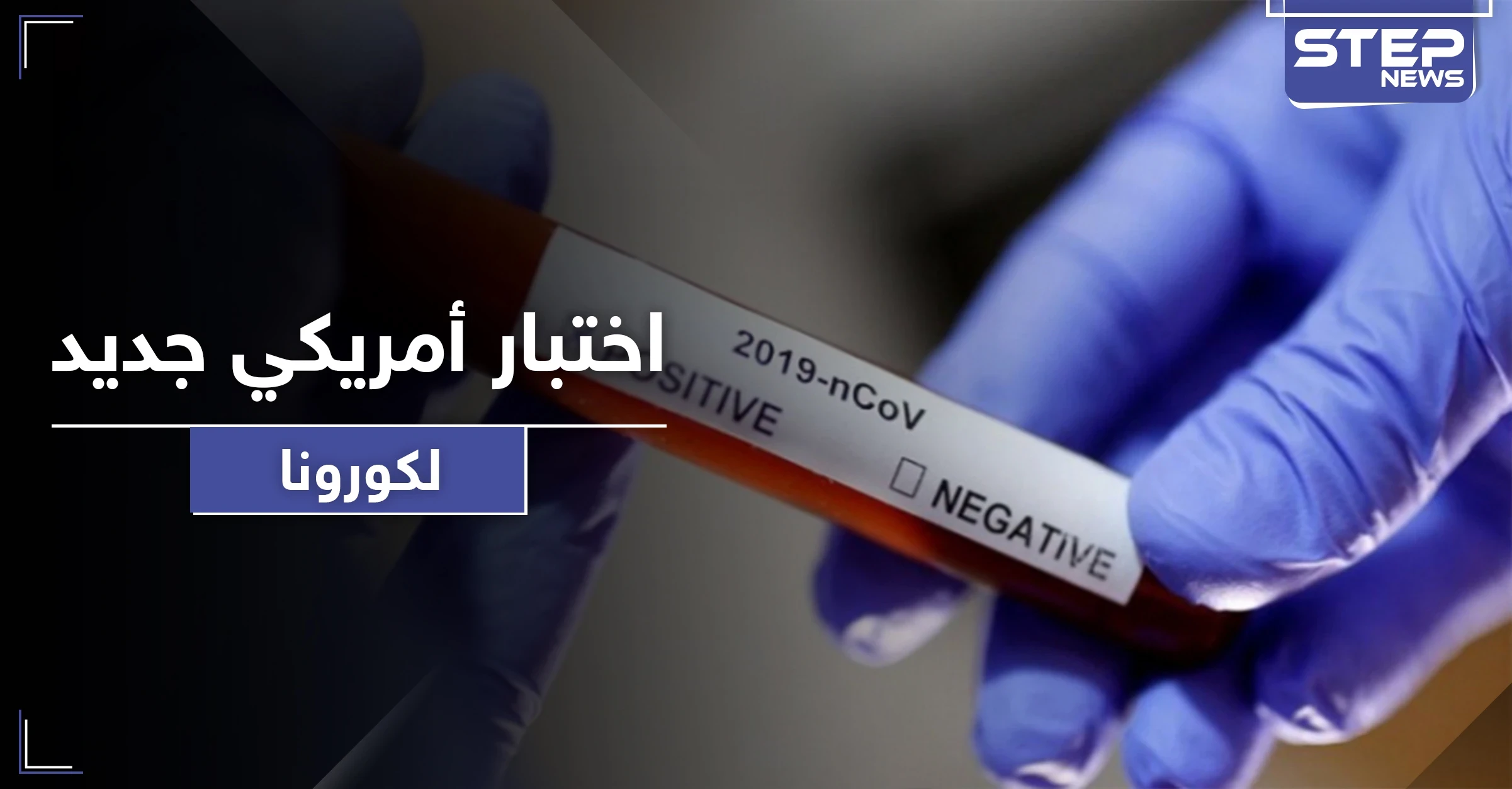 اختبار أمريكي جديد من شأنه كشف ملايين المصابين بكورونا بوقت قياسي