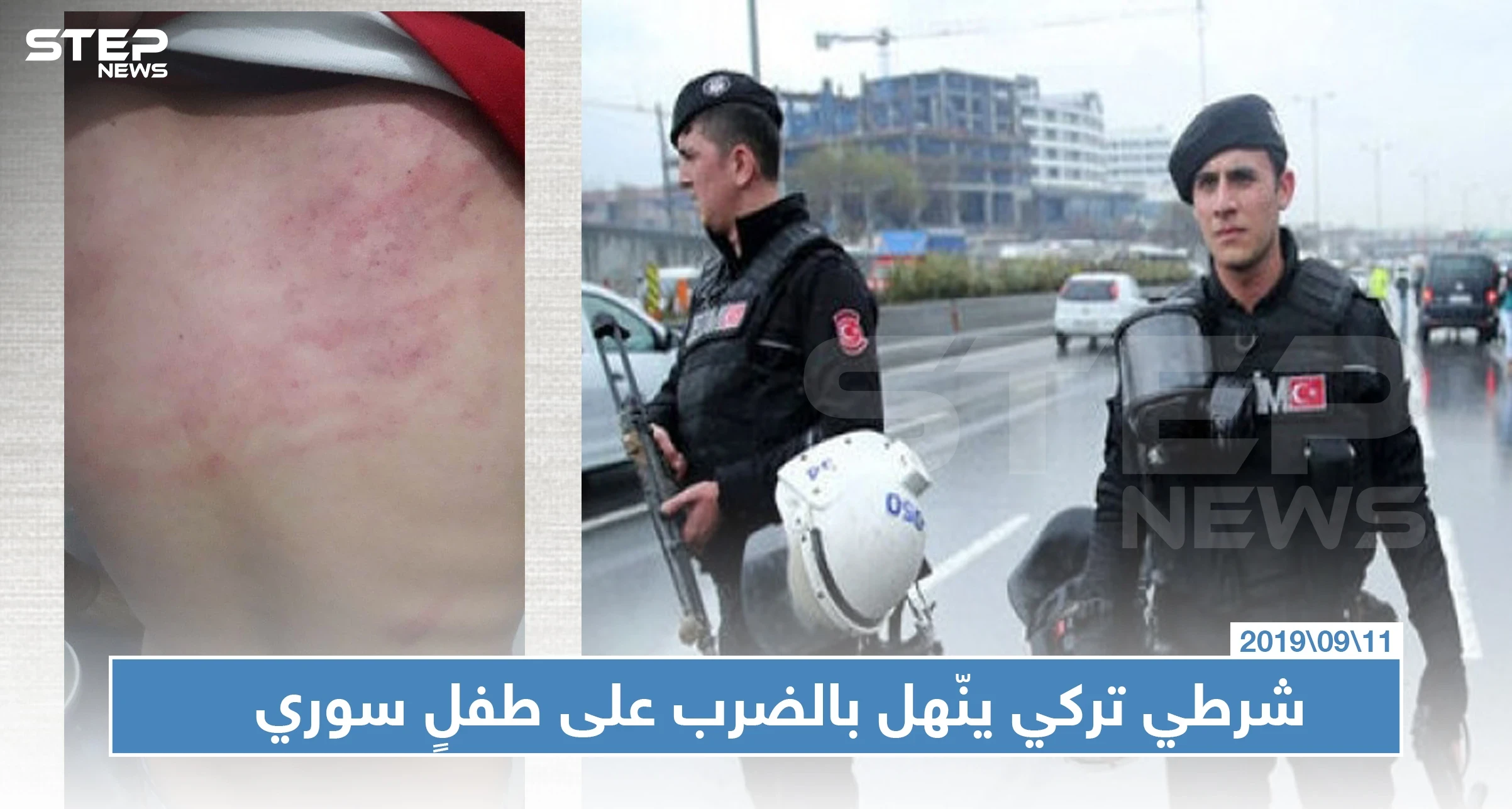 شرطي تركي ينّهل بالضرب على طفلٍ سوري يعمل والأخير يردد "لا أحد يحبنا"
