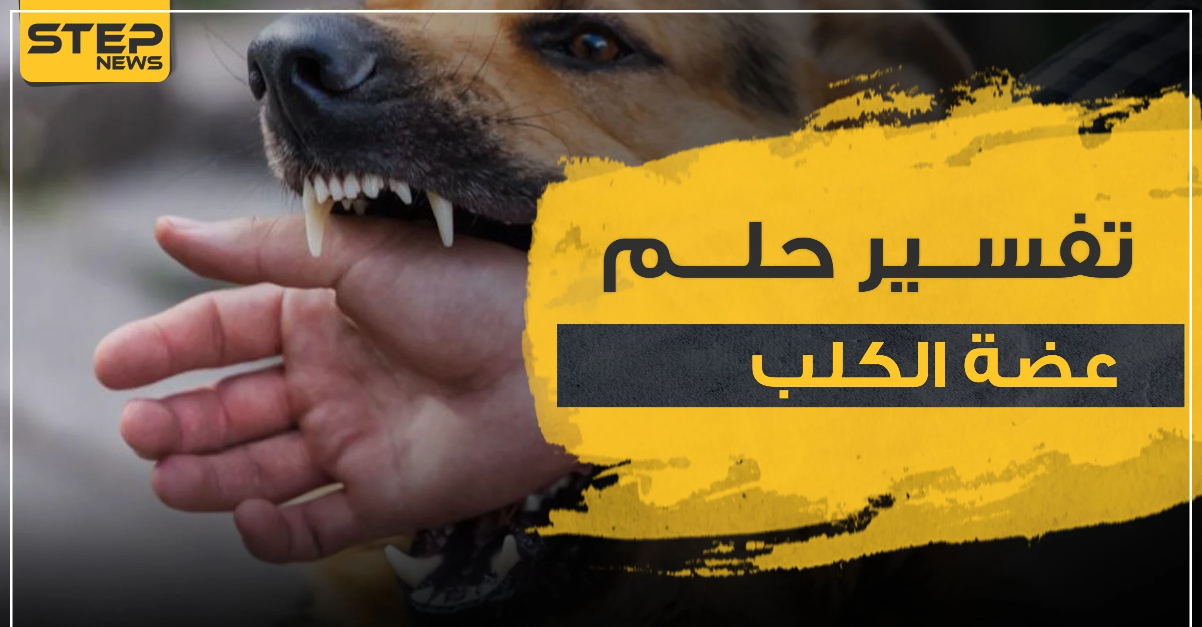 تفسير حلم عضة الكلب في المنام و4 دلالات في رؤيته للعامة في المنام