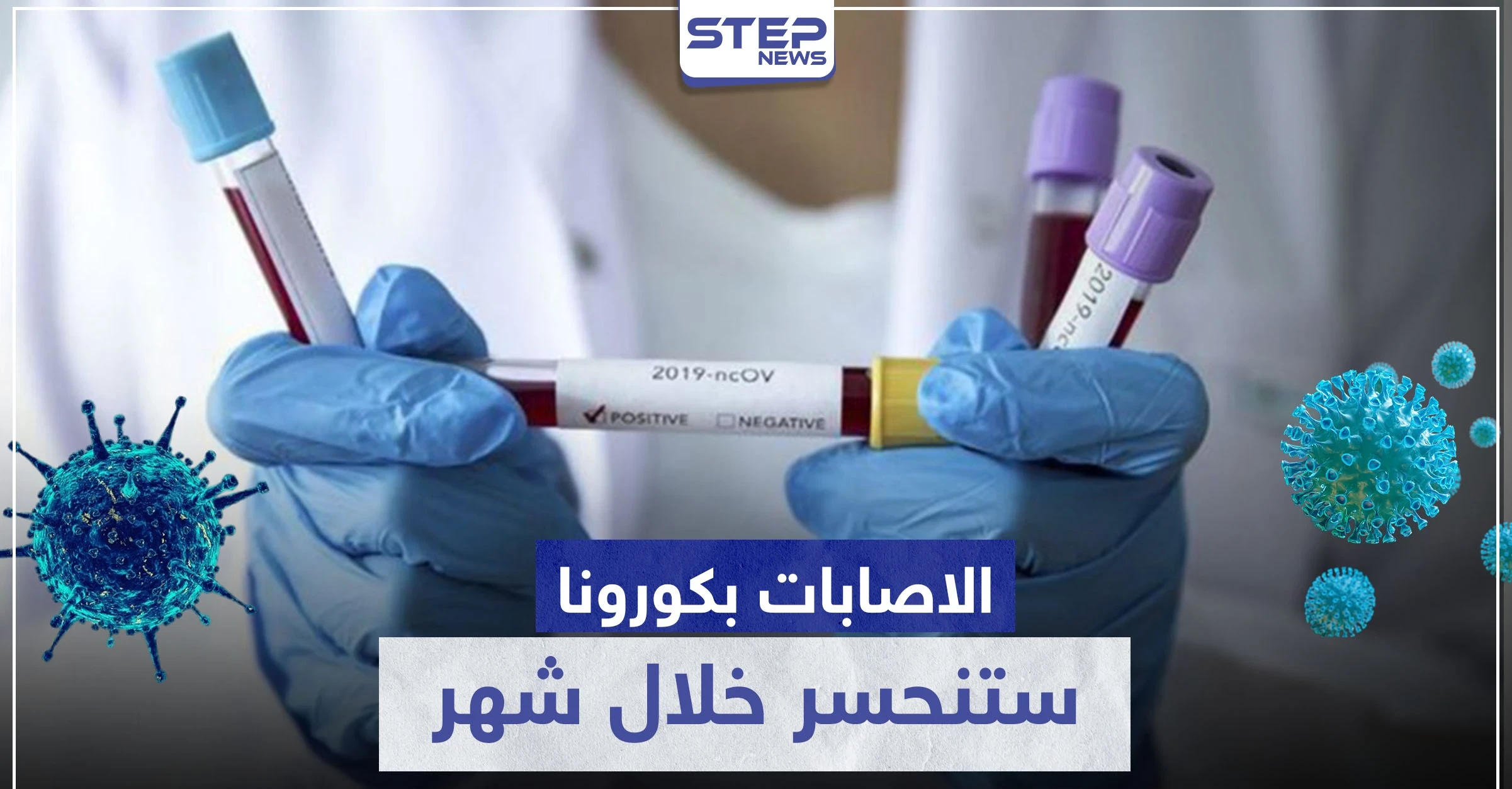 طبيب فرنسي شهير: الإصابات بـ فيروس كورونا ستنحسر خلال شهر