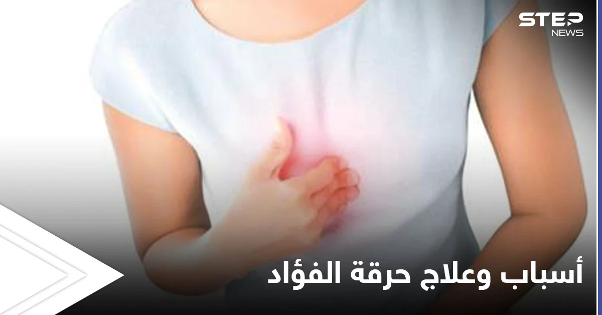 حرقة الفؤاد.. حموضة في المعدة وعسر في الهضم إليك أهم الأسباب وطرق العلاج