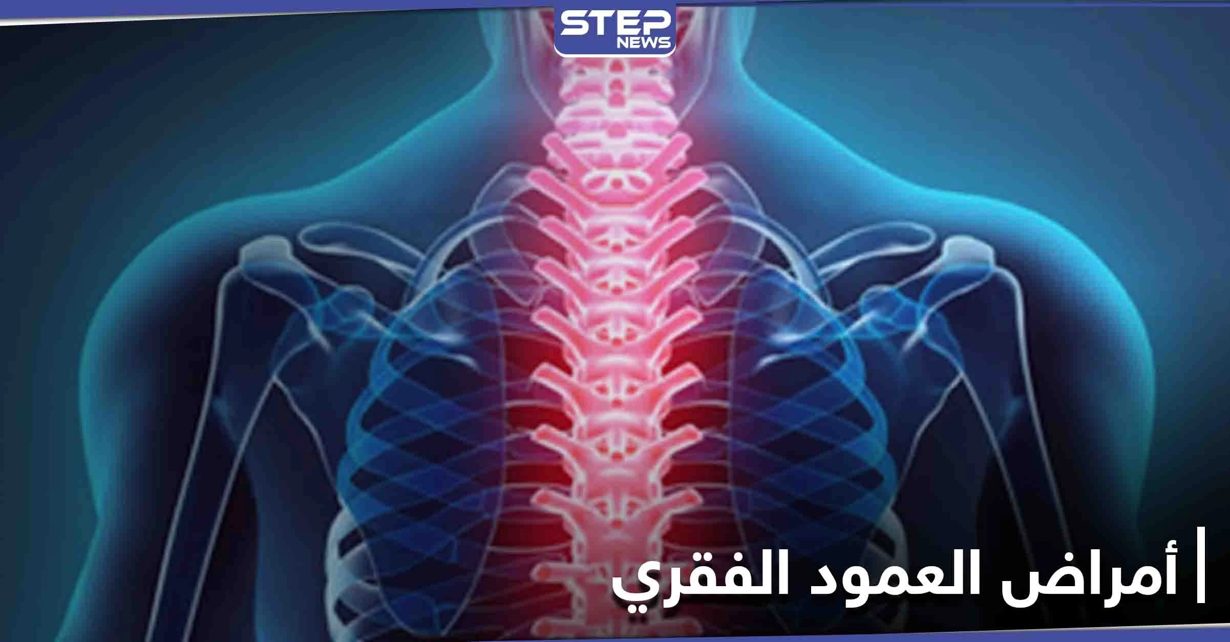 منها السُمنة.. تعرف على أسباب الأمراض التي تصيب العمود الفقري ومدى خطورتها وطرق العلاج