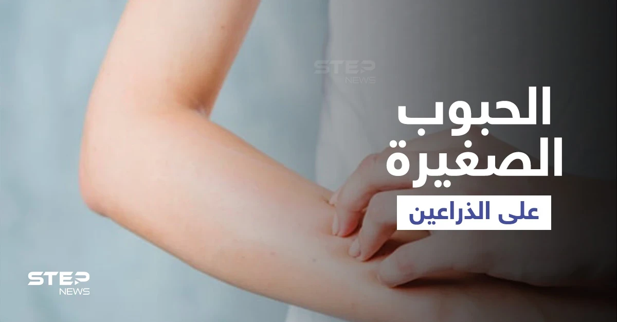 أسباب ظهور حبوب صغيرة على الذراعين وطرق علاجها إليك أهم المعلومات