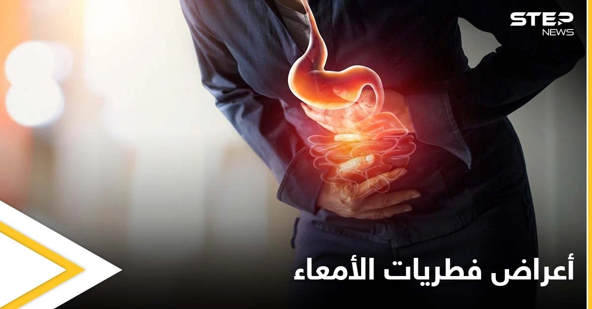 ما هي أعراض فطريات الأمعاء وخطورتها وأسباب الإصابة بها تعرف على التفاصيل