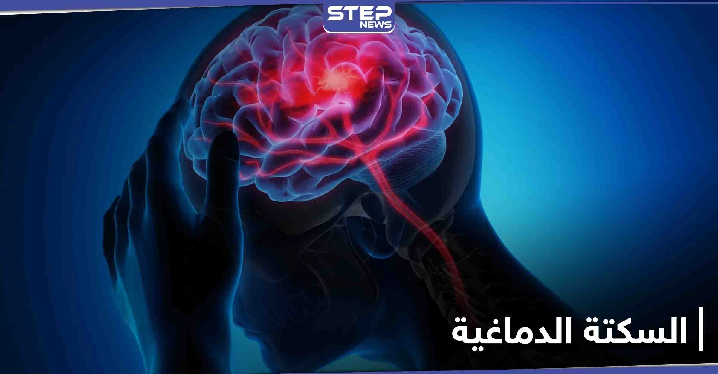السكتة الدماغية تنهي حياة أعداد كبيرة يومياً.. أعراضها وطرق الوقاية منها