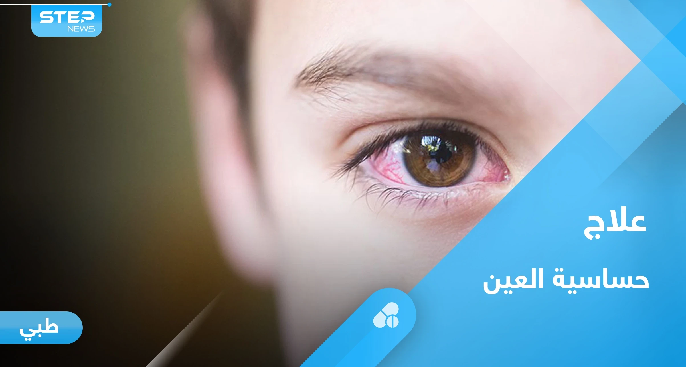 تعرف على علاج حساسية العين عند الاطفال بطرق مختلفة