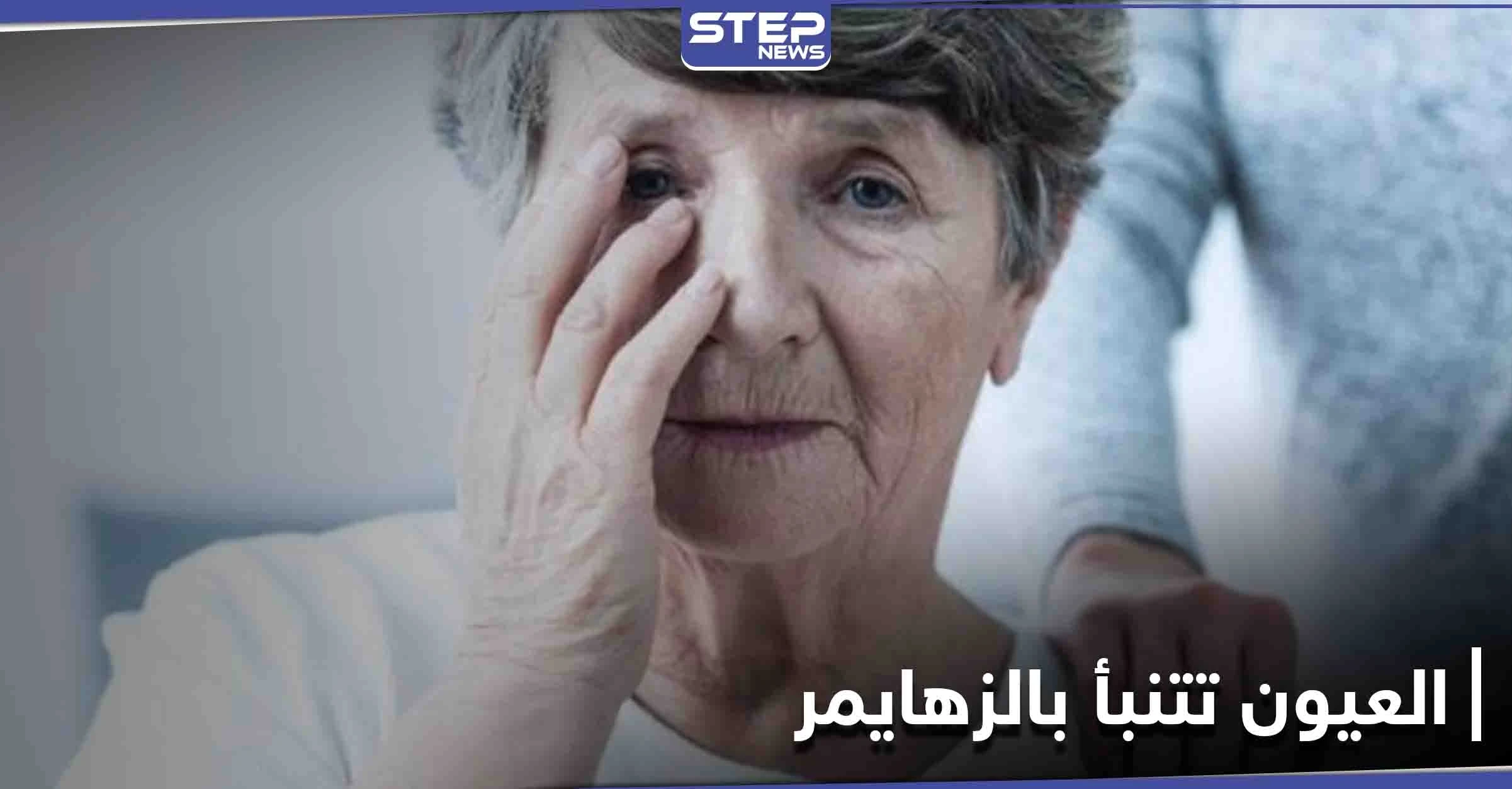 كيف تقدم العيون تنبؤات بحدوث مرض الزهايمر وما هي أبرز الإشارات