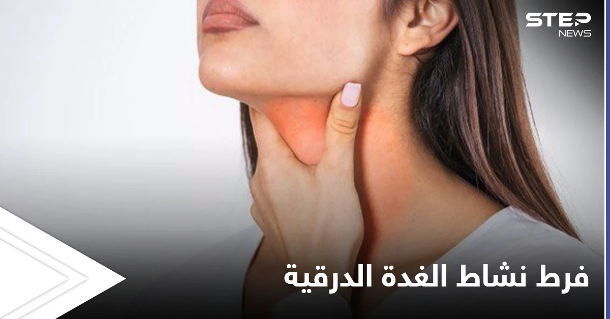 أهم الأعشاب لعلاج فرط نشاط الغدة الدرقية تعرف عليها