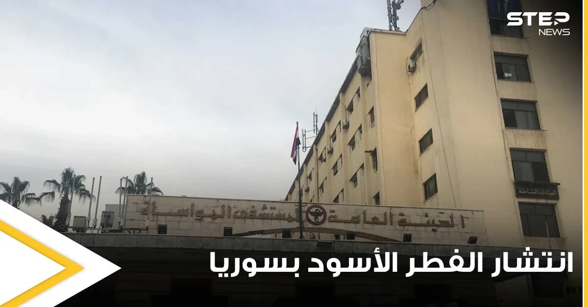 وسط ازدياد حالات الإصابة.. مدير إحدى المستشفيات السورية يكشف سبب زياة انتشار الفطر الأسود